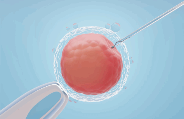 Intracytoplasmic Sperm Injection