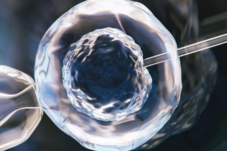 Laser Assisted Hatching