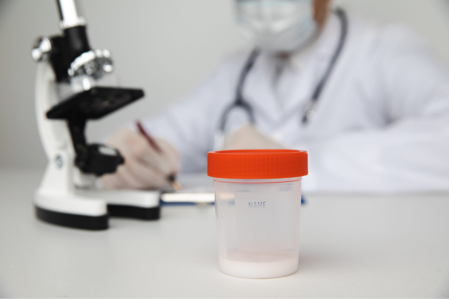 Semen Analysis